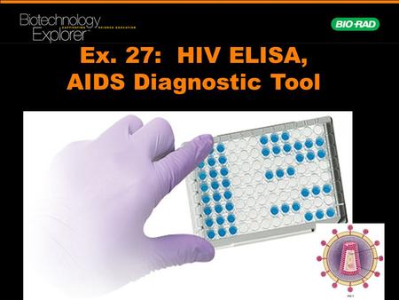 Ex. 27: HIV ELISA, AIDS Diagnostic Tool. Human Immuno- deficiency Virus (HIV) First diagnosed in 1981 Over 20 million deaths worldwide, over a half million.