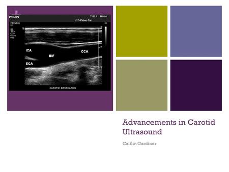 + Advancements in Carotid Ultrasound Caitlin Gardiner.