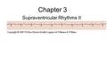 Chapter 3 Supraventricular Rhythms II. Atrial Fibrillation.