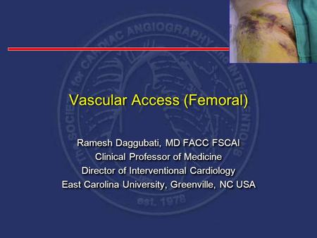 Vascular Access (Femoral) Ramesh Daggubati, MD FACC FSCAI Clinical Professor of Medicine Director of Interventional Cardiology East Carolina University,
