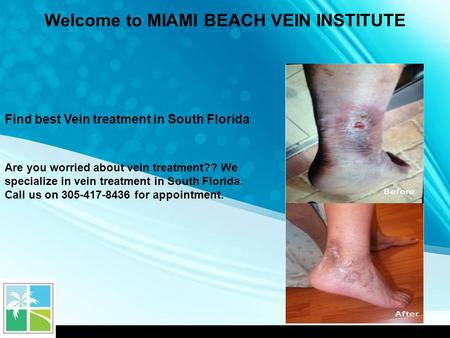 Find best Vein treatment in South Florida Are you worried about vein treatment?? We specialize in vein treatment in South Florida. Call us on 305-417-8436.