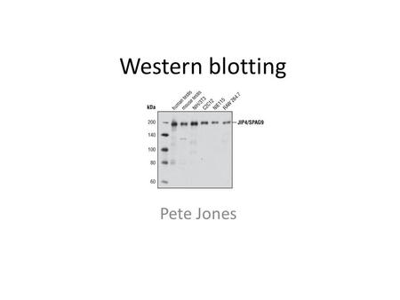 Western blotting Pete Jones.