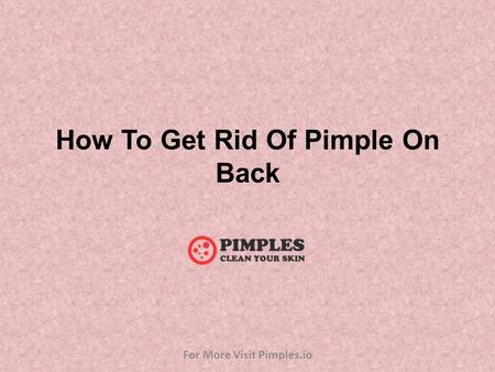 How To Get Rid Of Pimple On Back For More Visit Pimples.io.