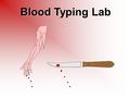 Blood Typing Lab. AB AB O IAIA IBIB I A I B I A person’s blood type is determined by the type of antigen, or blood protein, carried in the blood. A person.