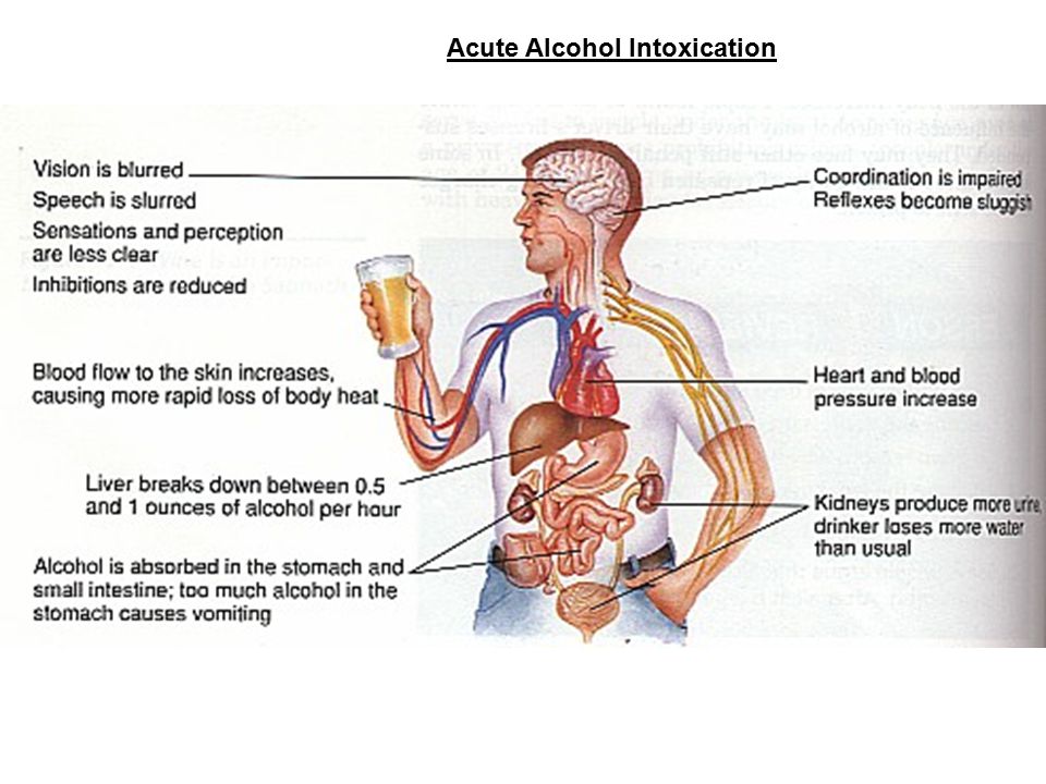 Acute+Alcohol+Intoxication.jpg