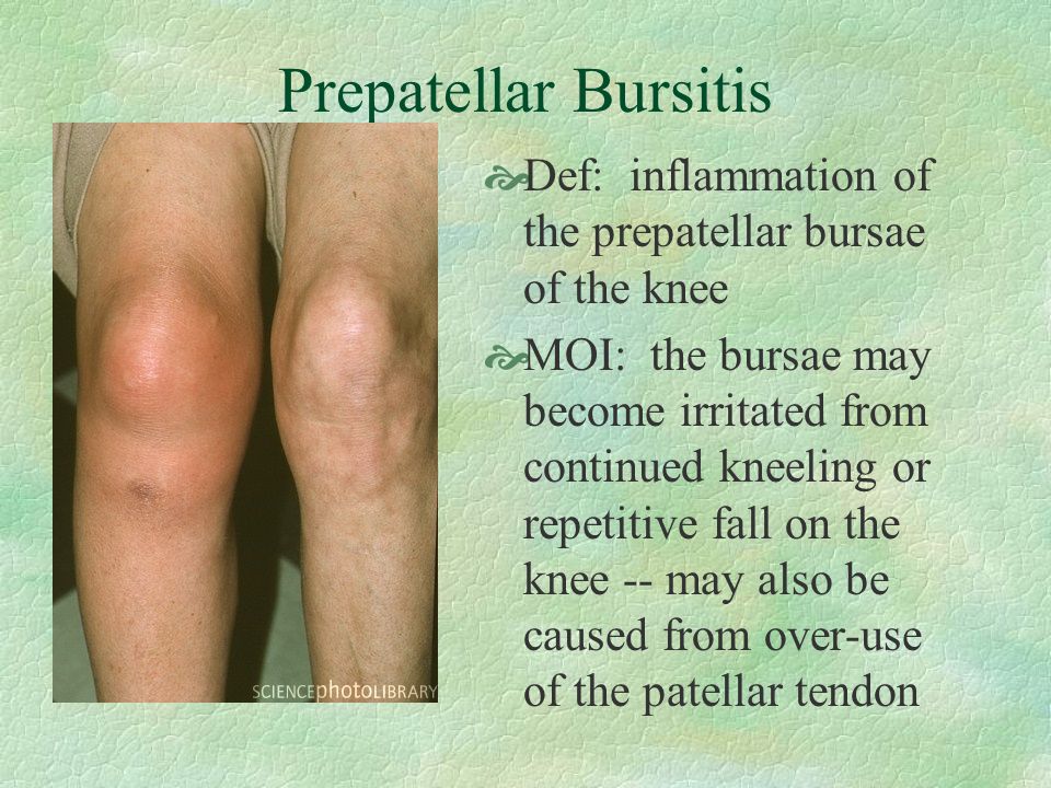how to use pre wrap on knee