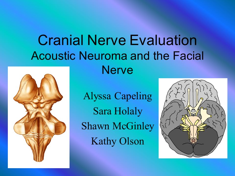 Acoustic Neuroma Facial Nerve 93
