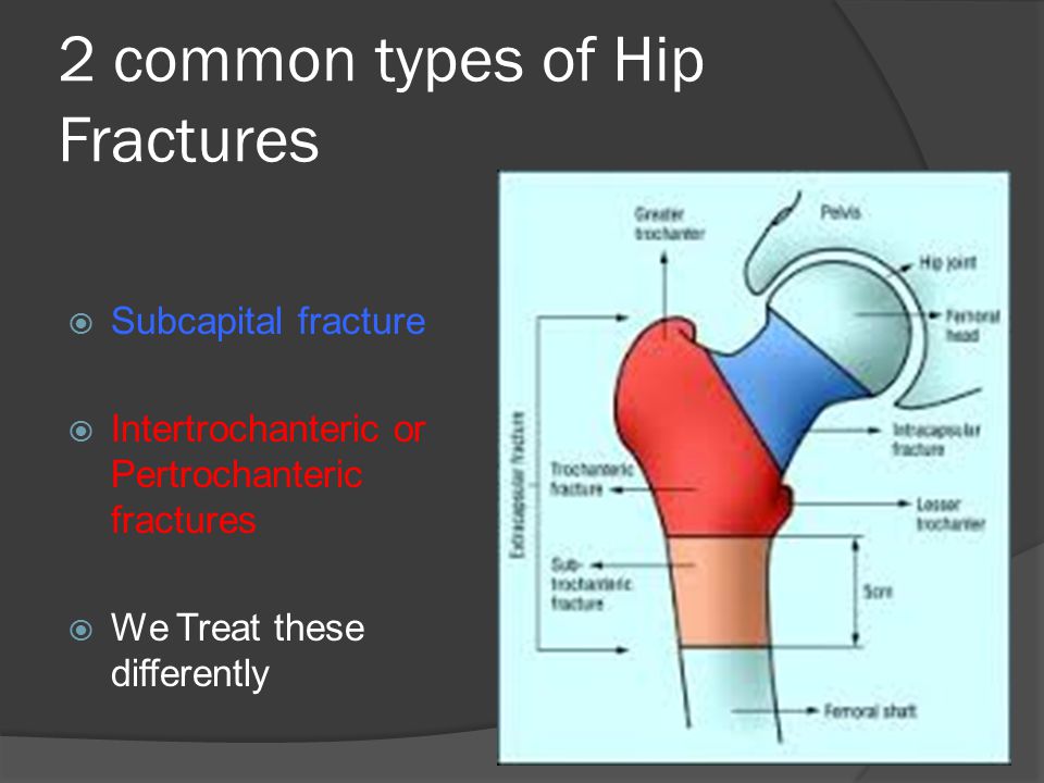 Orthosports - Orthopaedic Surgeons Knee Surgery