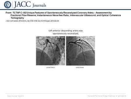 Date of download: 5/29/2016 Copyright © The American College of Cardiology. All rights reserved. From: TCTAP C-162 Unique Features of Spontaneously Recanalyzed.