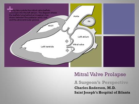 + Mitral Valve Prolapse A Surgeon’s Perspective Charles Anderson, M.D. Saint Joseph’s Hospital of Atlanta.