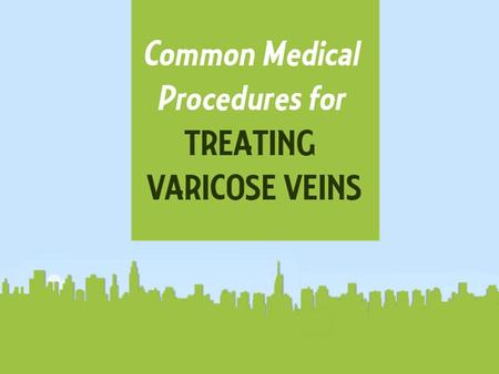 Common Medical Procedures for Treating Varicose Veins.