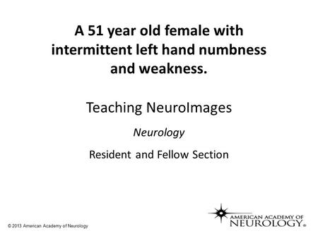 Teaching NeuroImages Neurology Resident and Fellow Section A 51 year old female with intermittent left hand numbness and weakness. © 2013 American Academy.