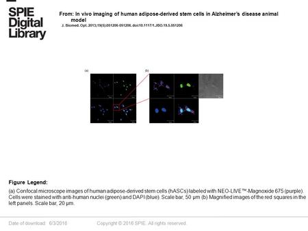 Date of download: 6/3/2016 Copyright © 2016 SPIE. All rights reserved. (a) Confocal microscope images of human adipose-derived stem cells (hASCs) labeled.