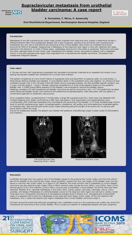 Supraclavicular metastasis from urothelial bladder carcinoma: A case report S. Farmahan, T. Mirza, P. Ameerally Oral Maxillofacial Department, Northampton.