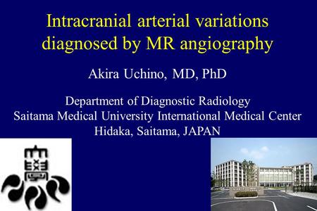 Intracranial arterial variations diagnosed by MR angiography