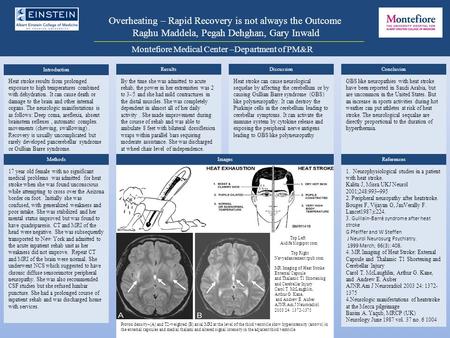 Overheating – Rapid Recovery is not always the Outcome Raghu Maddela, Pegah Dehghan, Gary Inwald Montefiore Medical Center –Department of PM&R ResultsConclusionDiscussion.