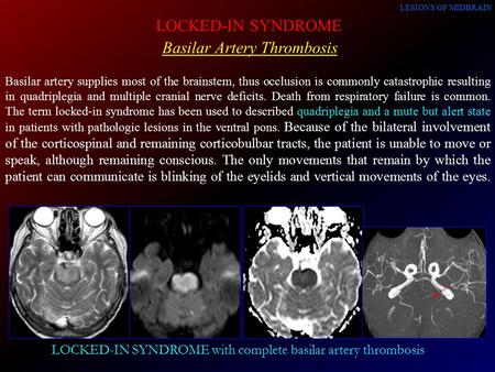 Erik K St Louis Md Ms Bradley F Boeve Md Mayo Clinic Proceedings