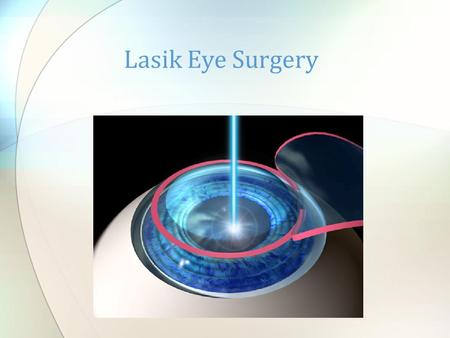Lasik Eye Surgery. What is a Lasik Eye Surgery? How a Lasik Eye Surgery works? Why this procedure is performed? What are the risks? What is required before.