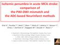 Ischemic penumbra in acute MCA stroke: comparison of the PWI-DWI mismatch and the ADC-based Neurinfarct methods Drier A 1, Tourdias T 2, Attal Y 3,