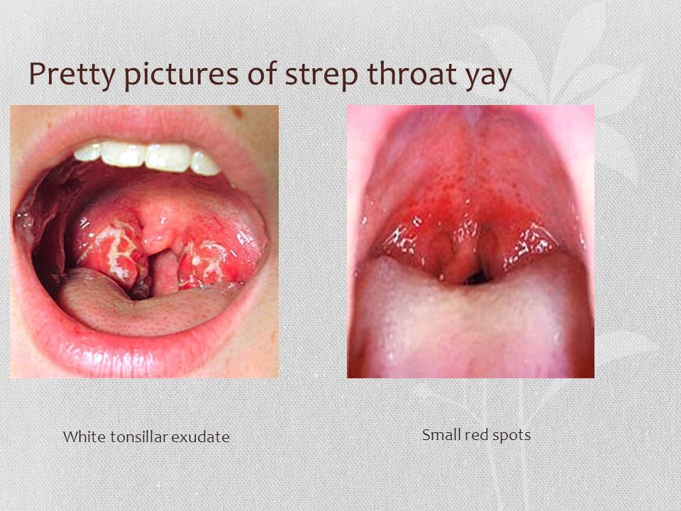 Pictures Of Step Throat 69
