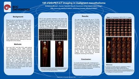 Background: Malignant pleural mesothelioma (MPM) is a rare and aggressive tumor with a complex growth pattern. Imaging plays a crucial role in diagnosis.