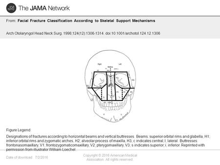 Date of download: 7/2/2016 Copyright © 2016 American Medical Association. All rights reserved. From: Facial Fracture Classification According to Skeletal.