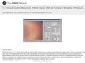 Date of download: 7/3/2016 Copyright © 2016 American Medical Association. All rights reserved. From: Computer-Assisted Measurement of Retinal Vascular.