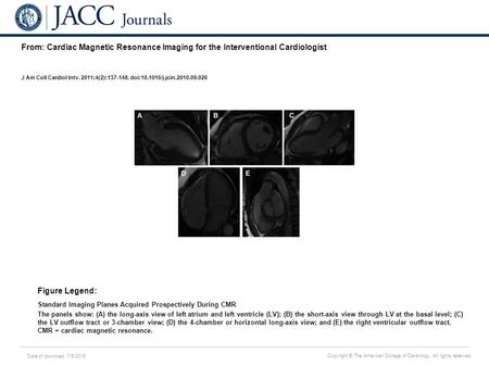 Date of download: 7/5/2016 Copyright © The American College of Cardiology. All rights reserved. From: Cardiac Magnetic Resonance Imaging for the Interventional.