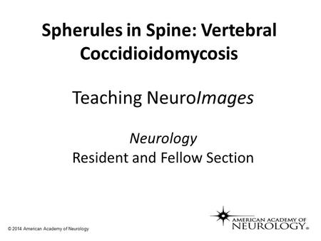 Teaching NeuroImages Neurology Resident and Fellow Section Spherules in Spine: Vertebral Coccidioidomycosis © 2014 American Academy of Neurology.