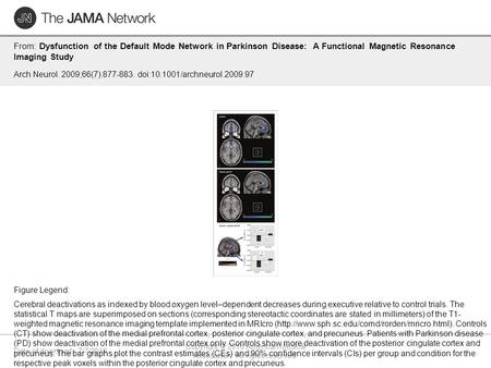 Date of download: 7/7/2016 Copyright © 2016 American Medical Association. All rights reserved. From: Dysfunction of the Default Mode Network in Parkinson.