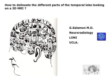 How to delineate the different parts of the temporal lobe looking on a 3D MRI ? G.Salamon M.D. Neuroradiology LONI UCLA.