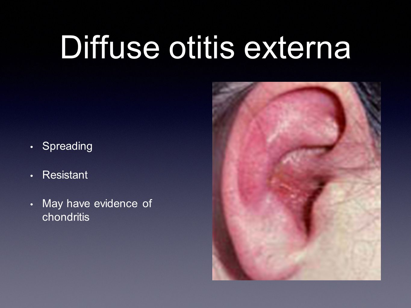 Image result for Otitis externa