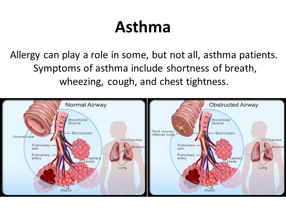 Lung Cancer Symptoms vs. Asthma