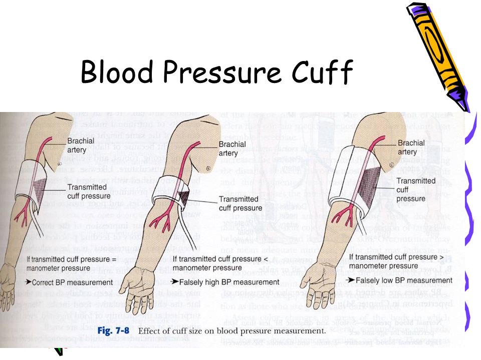 Blood Pressure Cuff Size Chart