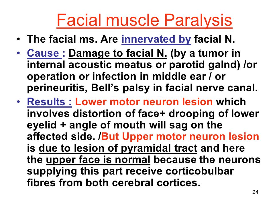 Facial Muscle Paralysis 39