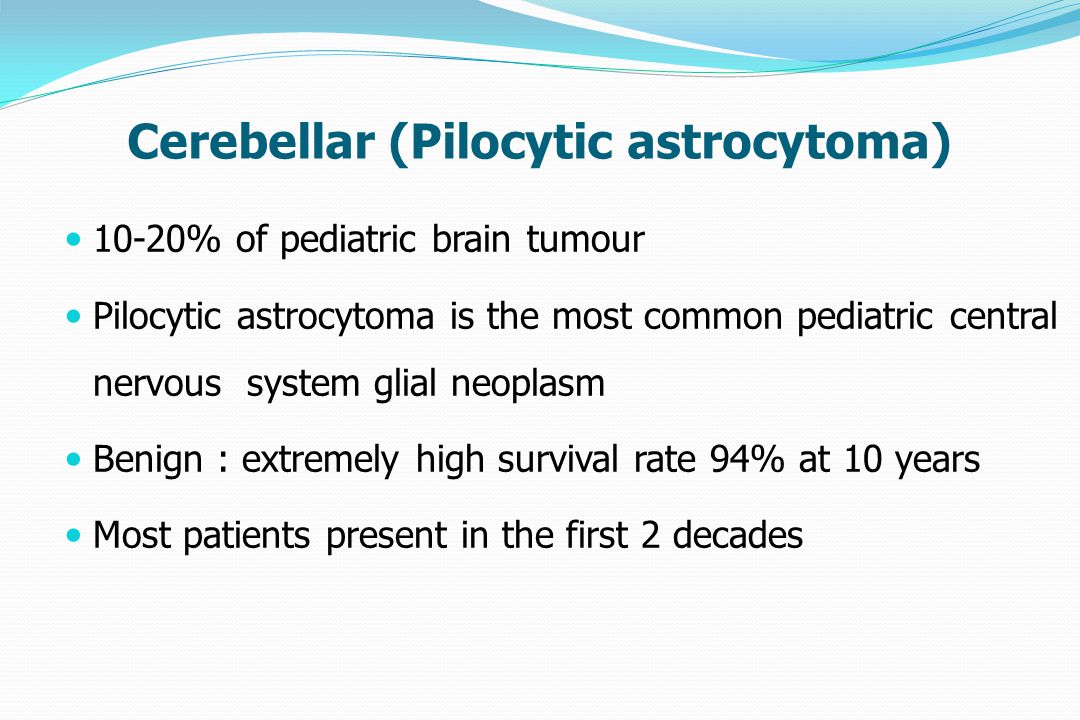 Astrocytoma In Adults 111