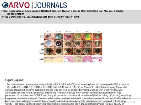 Date of download: 9/18/2016 The Association for Research in Vision and Ophthalmology Copyright © 2016. All rights reserved. From: Expression of Angiogenesis-Related.