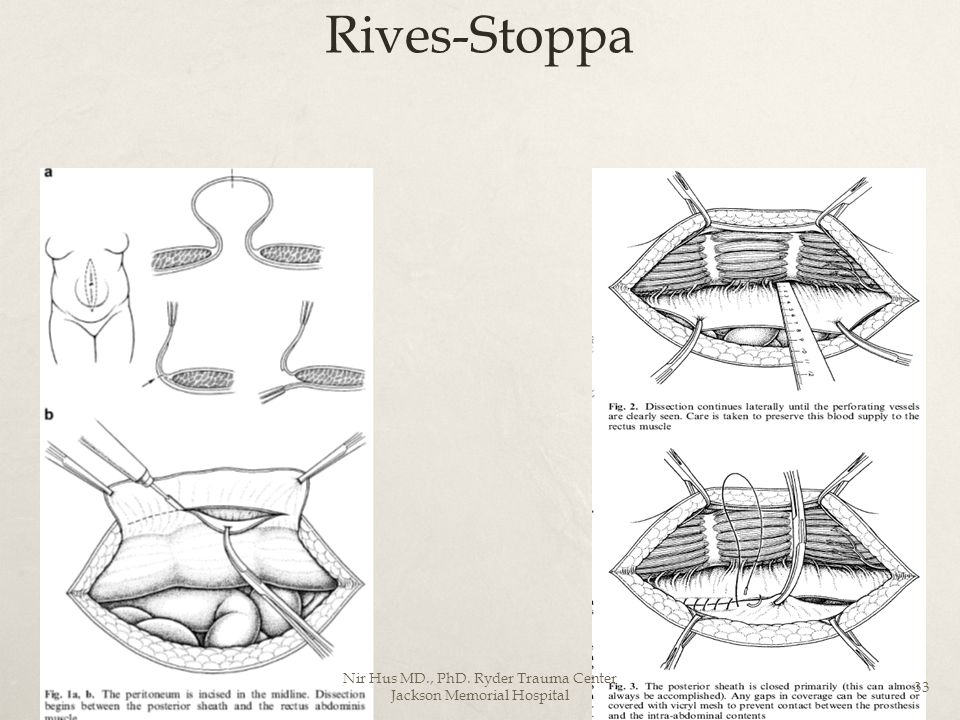 shop cladocera as model organisms in biology proceedings of the third international symposium on cladocera held