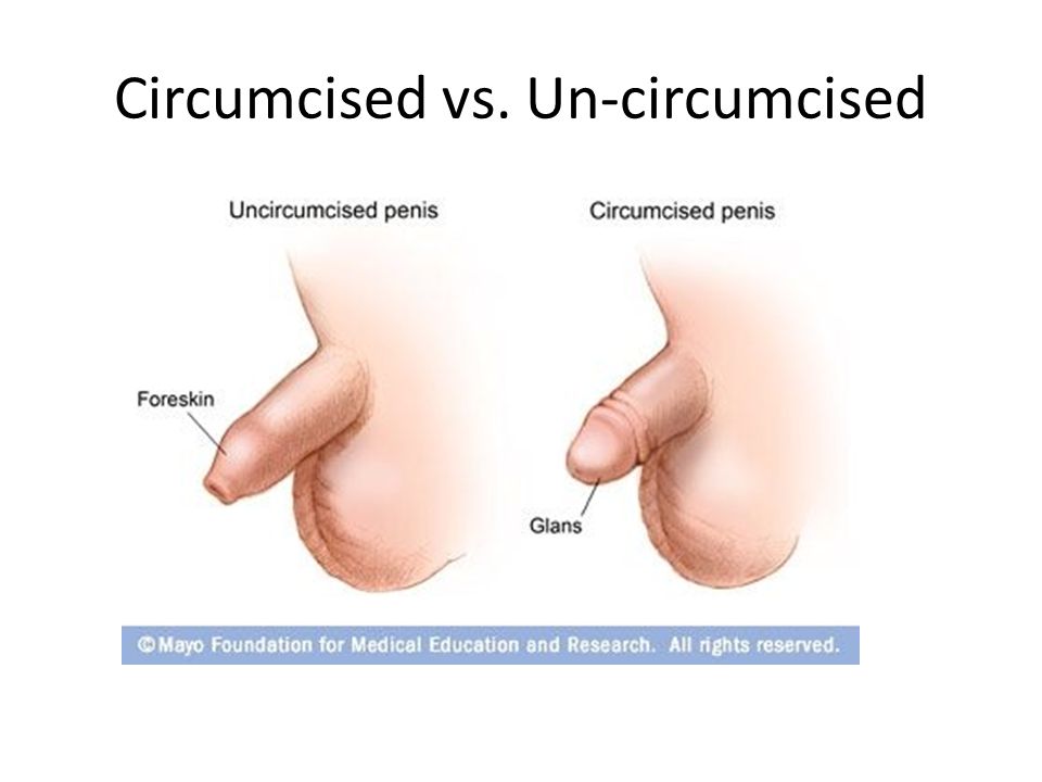 A Non Circumcised Penis 63
