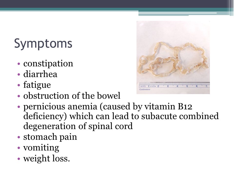 Anemia Caused By Weight Loss