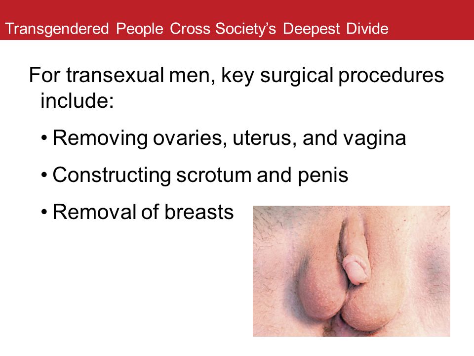 Transexual Vagina Pictures 20