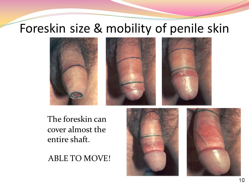 Penis With Forskin 93