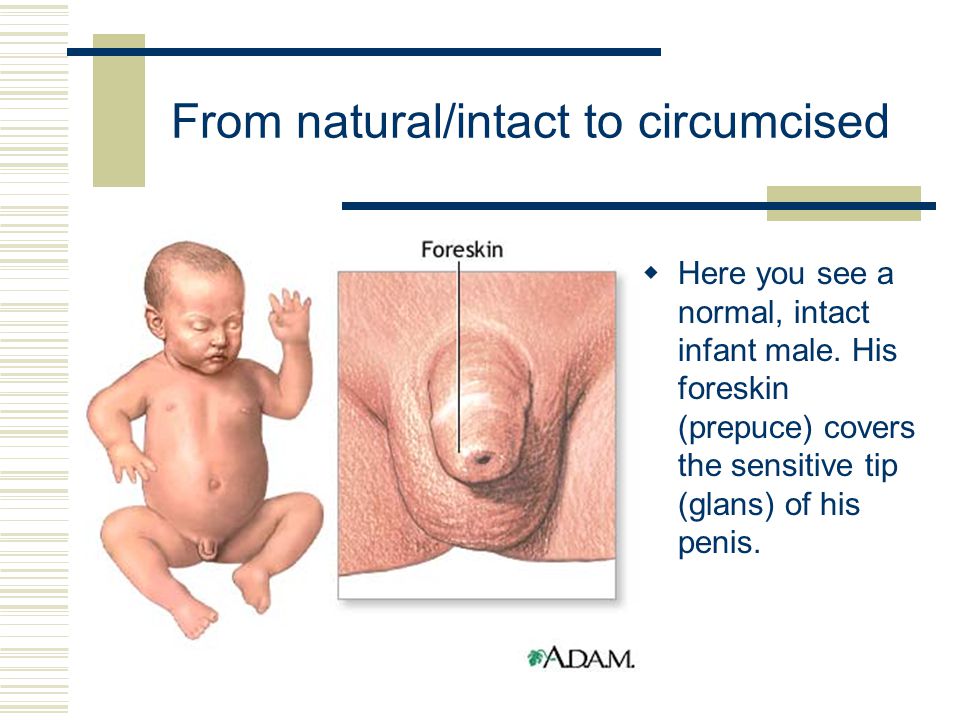 Pictures Of A Circumcised Penis 43