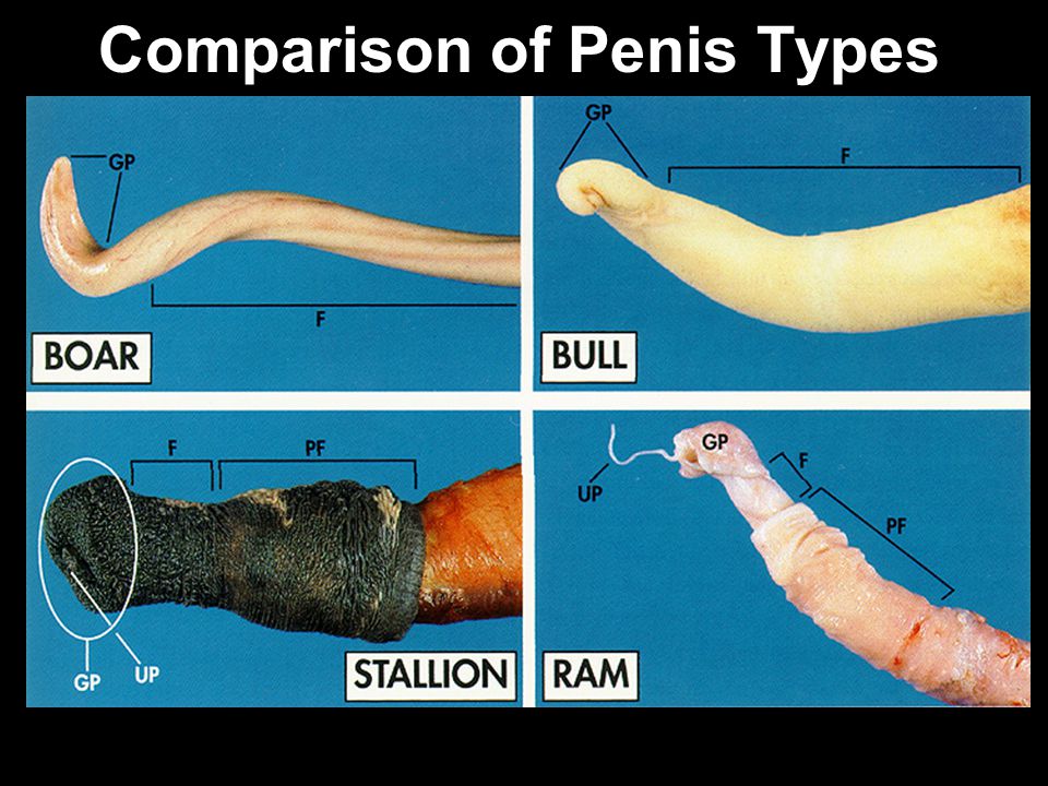 Types Of Penis Pictures 12