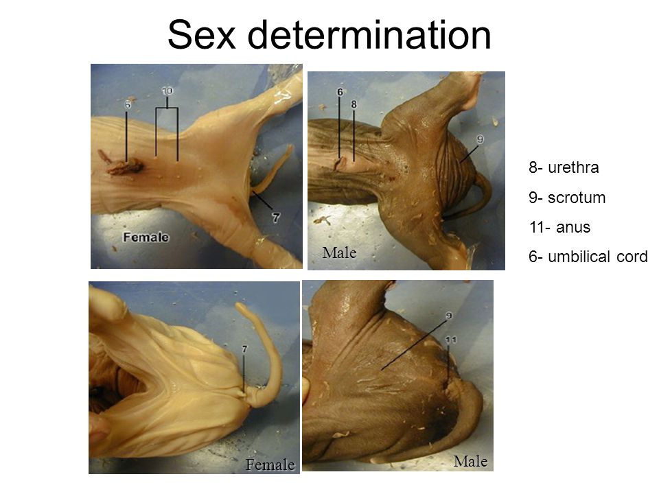 Female Fetal Sex 55