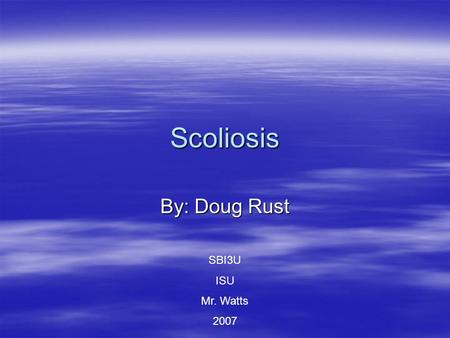 Scoliosis By: Doug Rust SBI3U ISU Mr. Watts 2007.