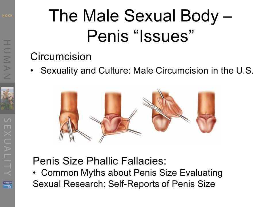 Circumcision Penis Size 41