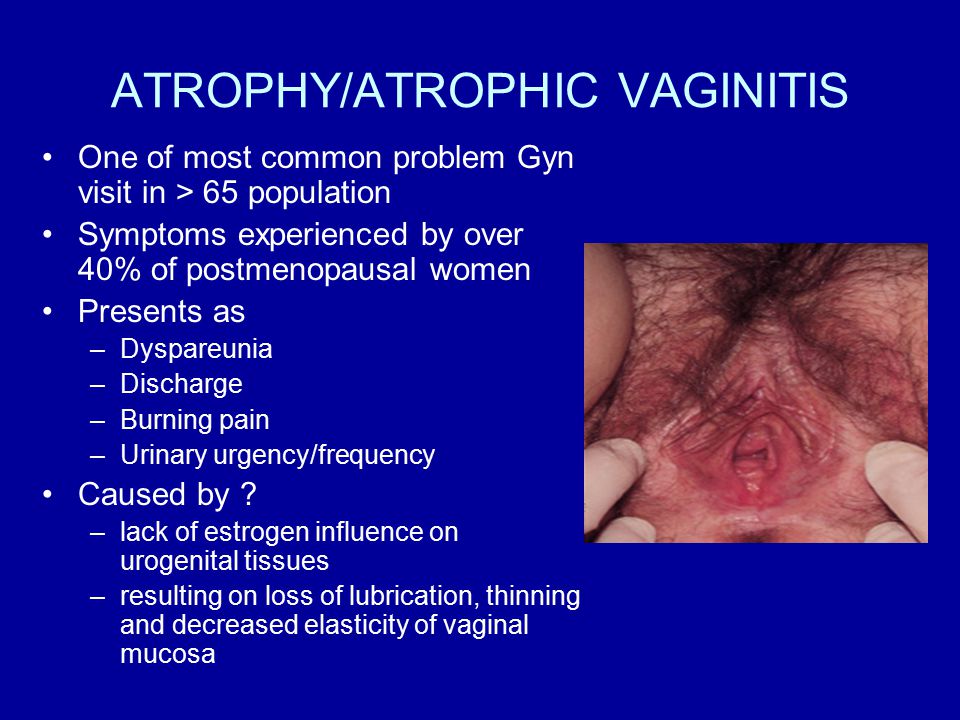 treatment of cervical cancer uptodate cervical cancer lymph nodes treatment