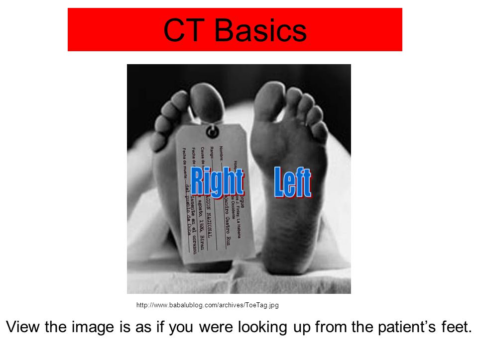 Download Fundamentals Of Body Ct Webb Download Fundamentals Of Body Ct Webb