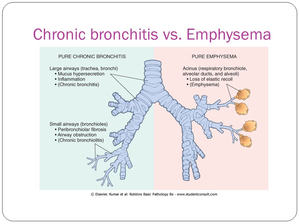 Chronic Bronchitis Weight Loss